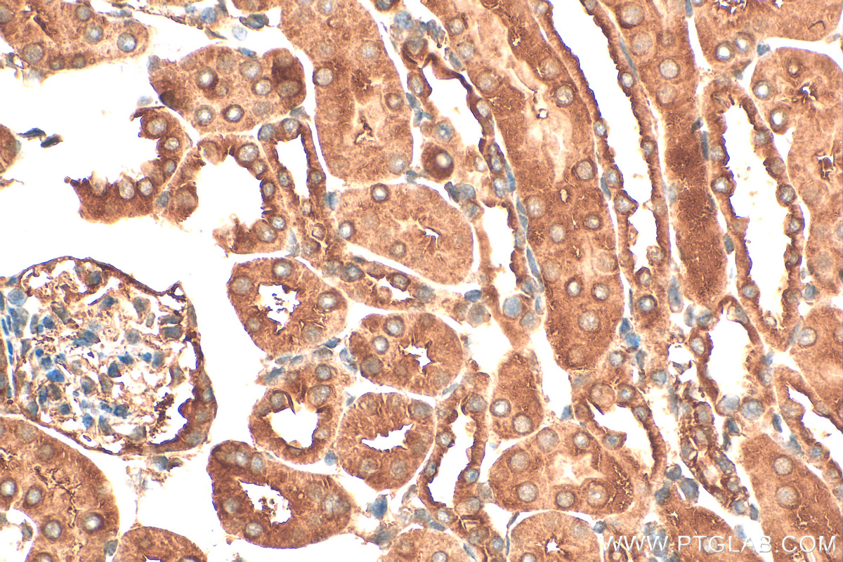 IHC staining of mouse kidney using 15882-1-AP