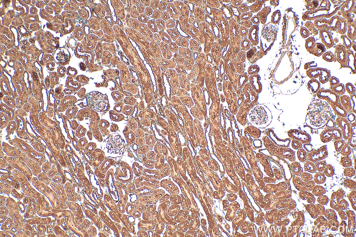 IHC staining of mouse kidney using 15882-1-AP