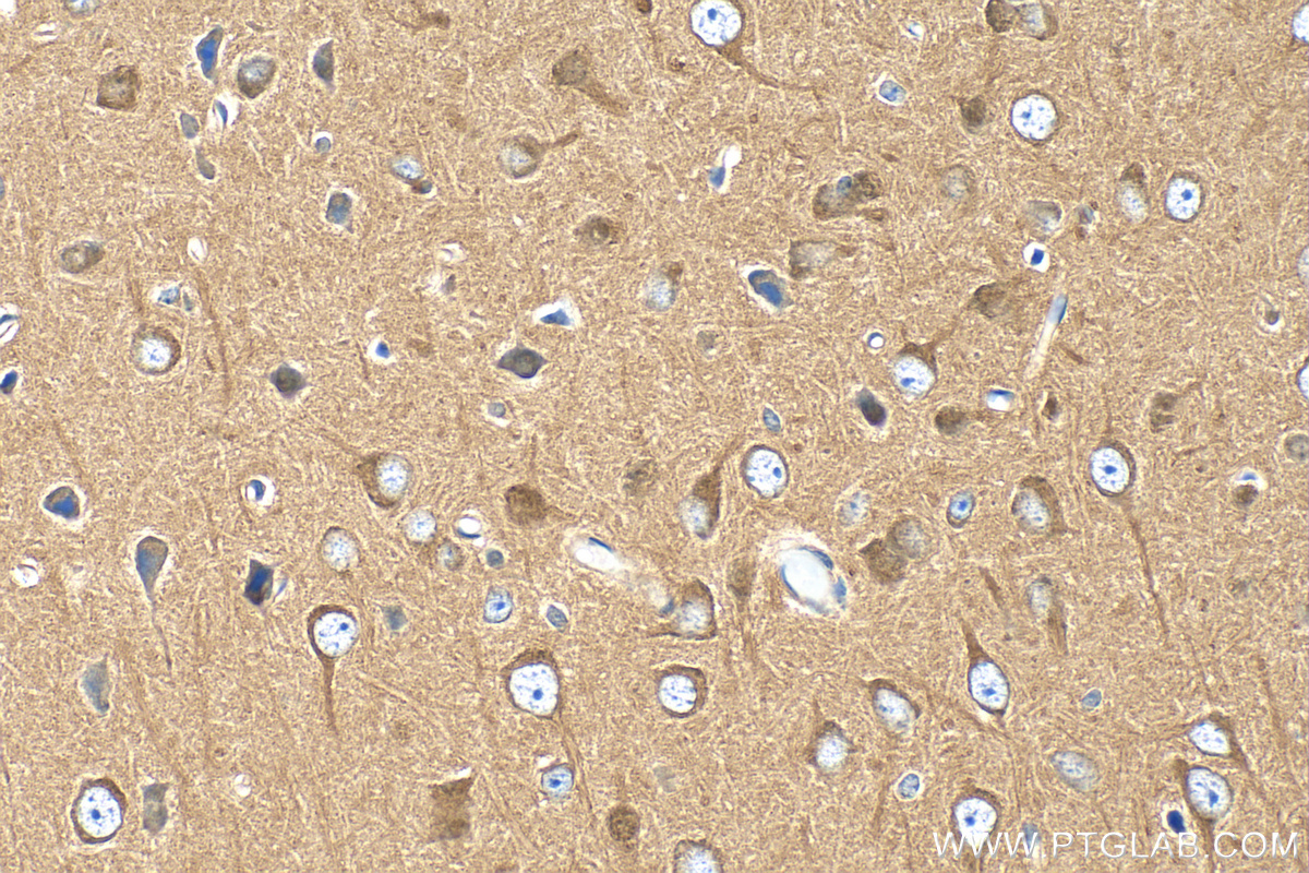 IHC staining of mouse brain using 29237-1-AP