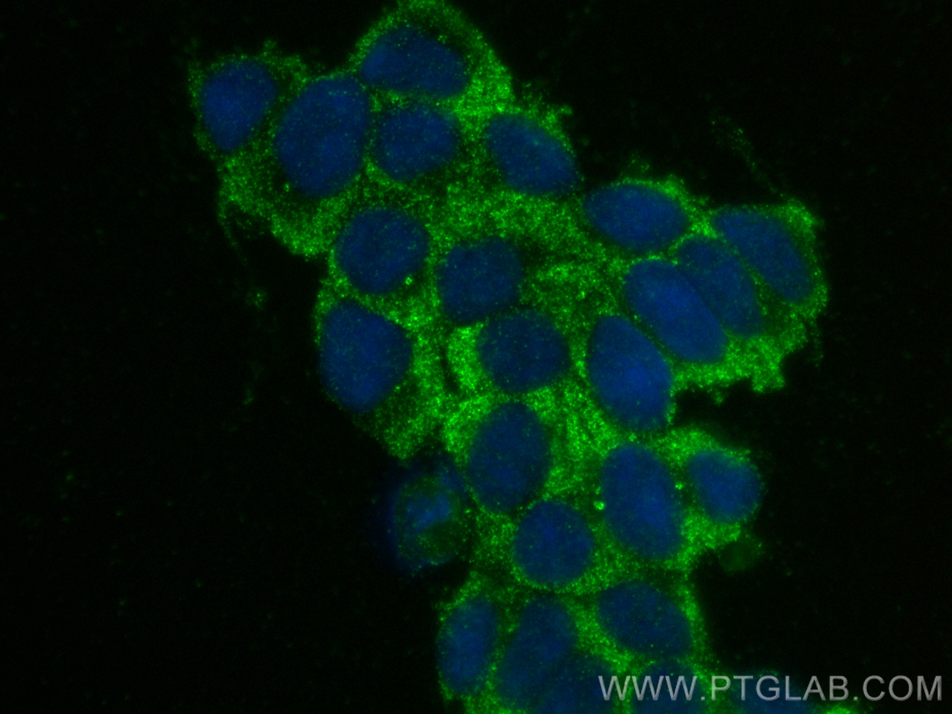 IF Staining of SH-SY5Y using 67783-1-Ig