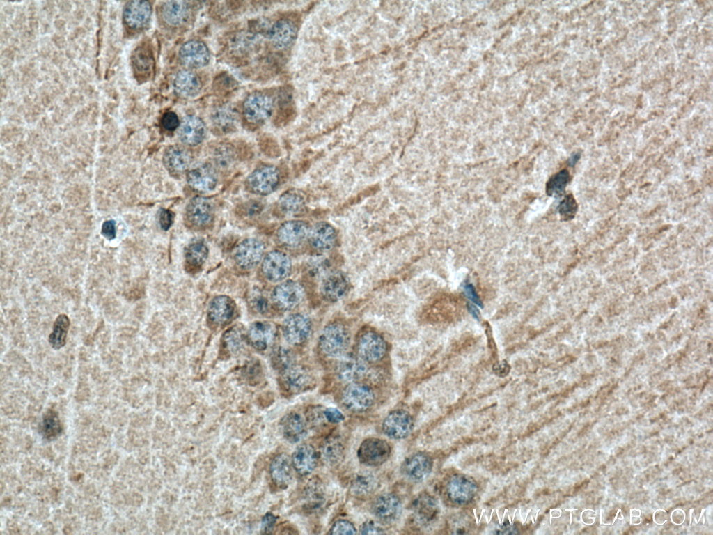 IHC staining of mouse brain using 67783-1-Ig (same clone as 67783-1-PBS)