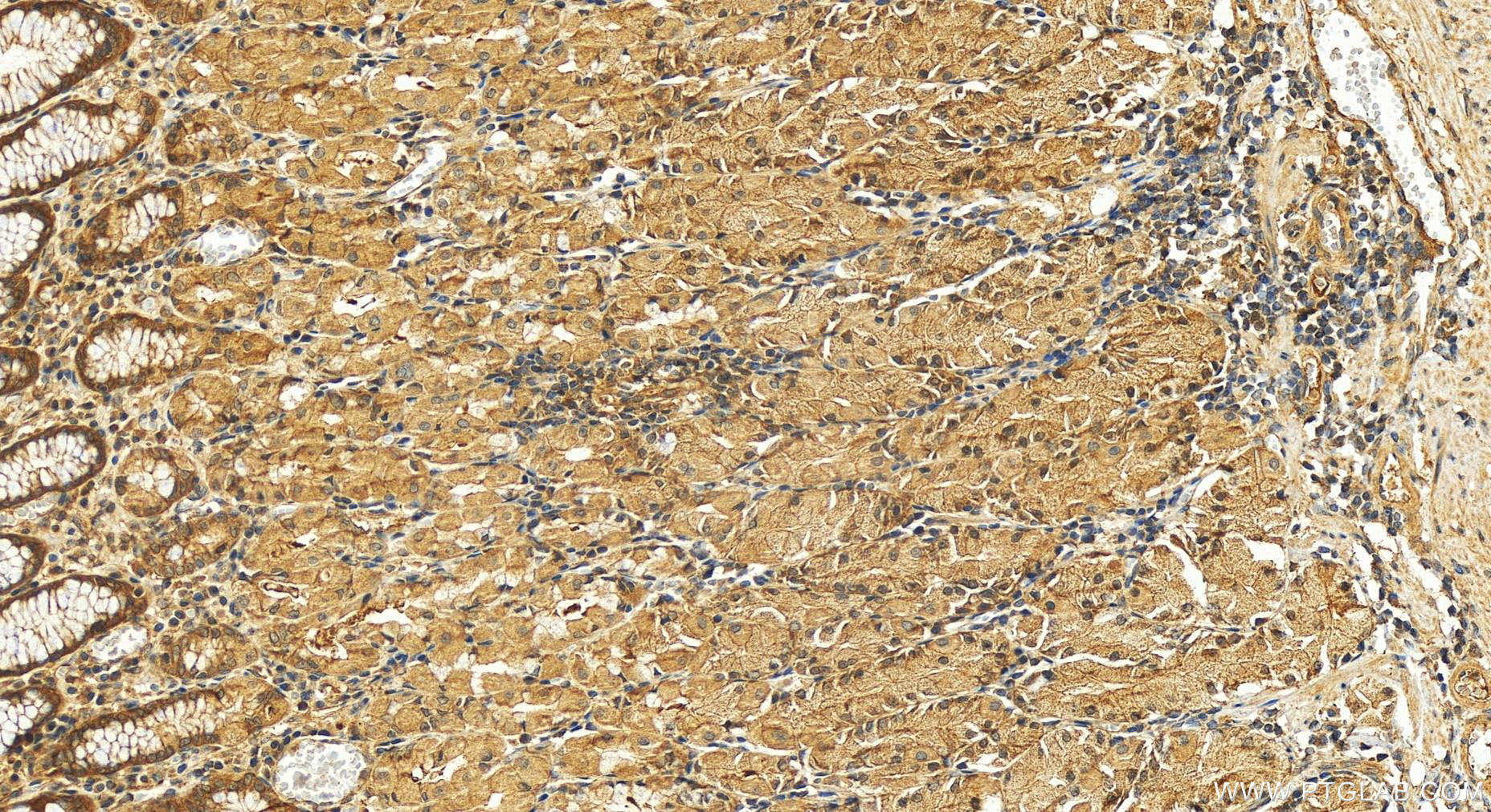 IHC staining of human stomach using 12068-1-AP