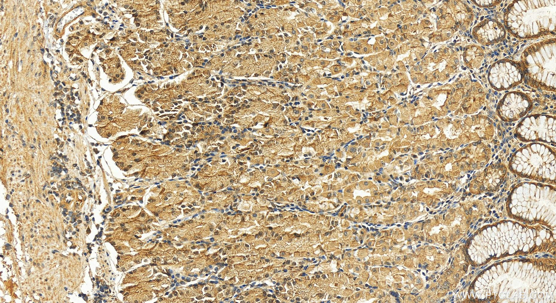 IHC staining of human stomach using 12068-1-AP