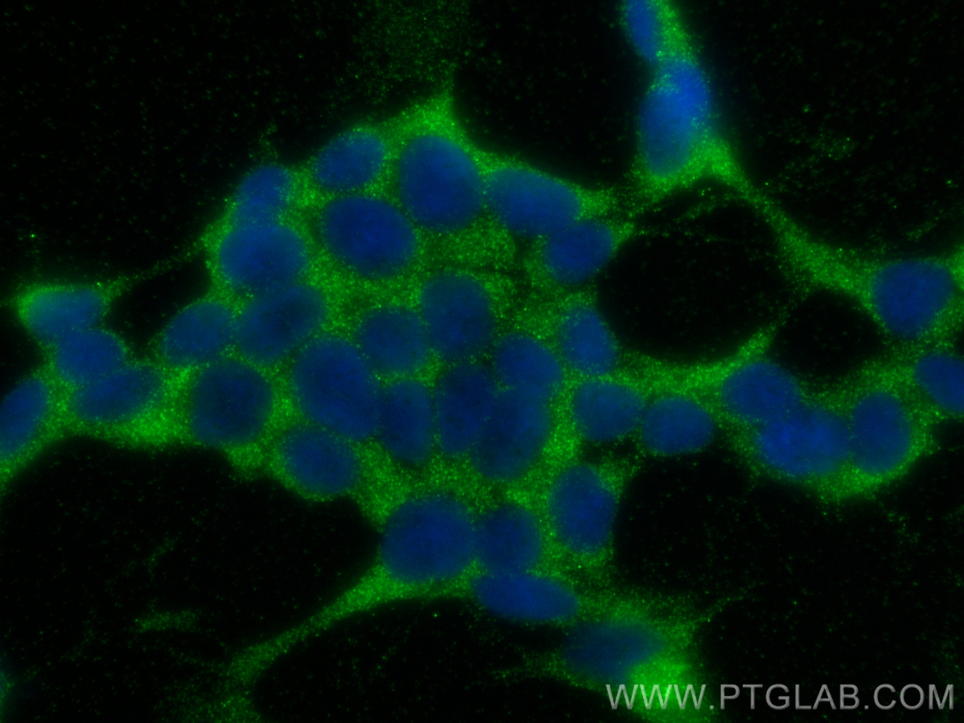 IF Staining of SH-SY5Y using 13422-1-AP