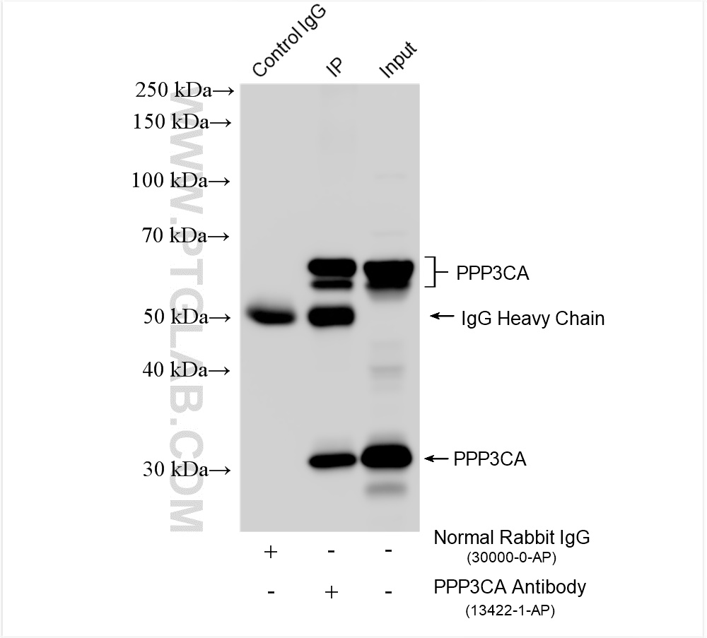 IP experiment of mouse brain using 13422-1-AP