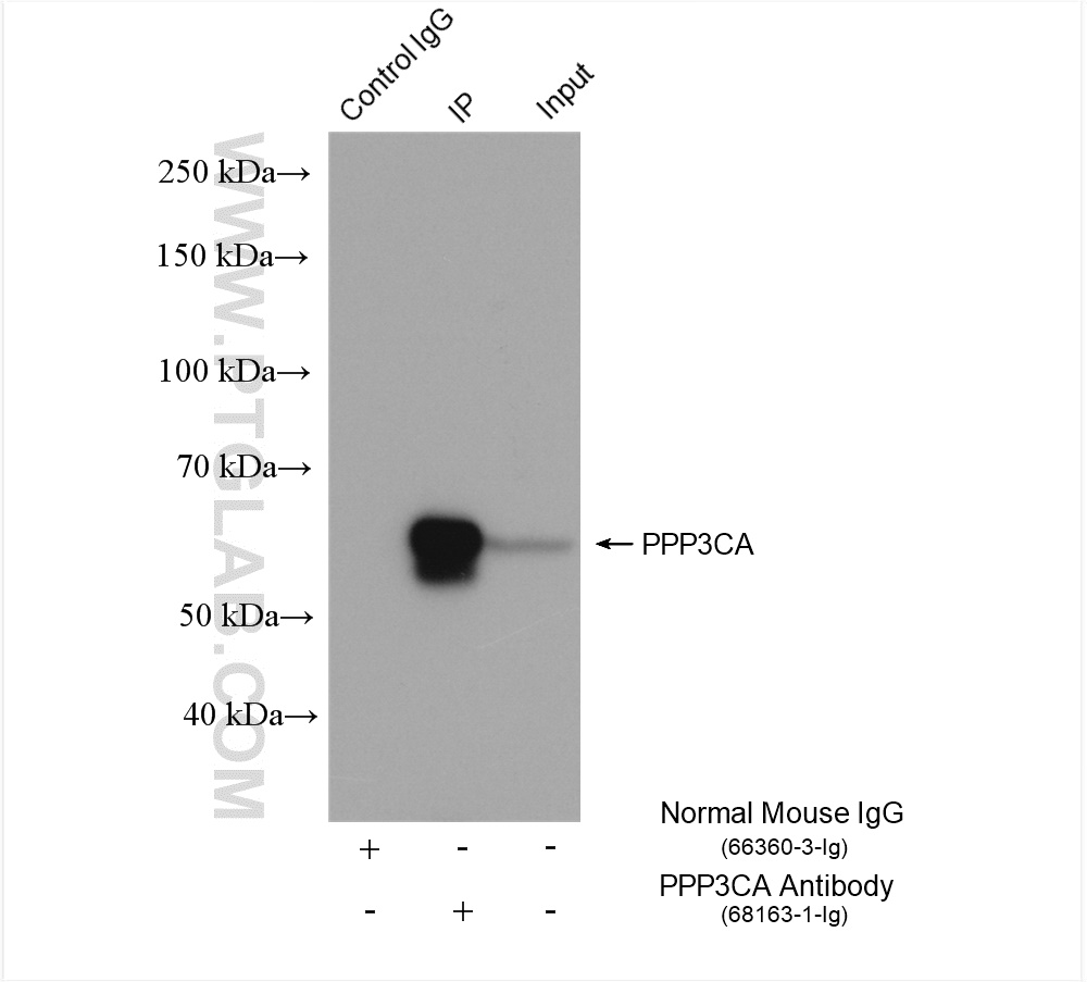 IP experiment of rat brain using 68163-1-Ig (same clone as 68163-1-PBS)