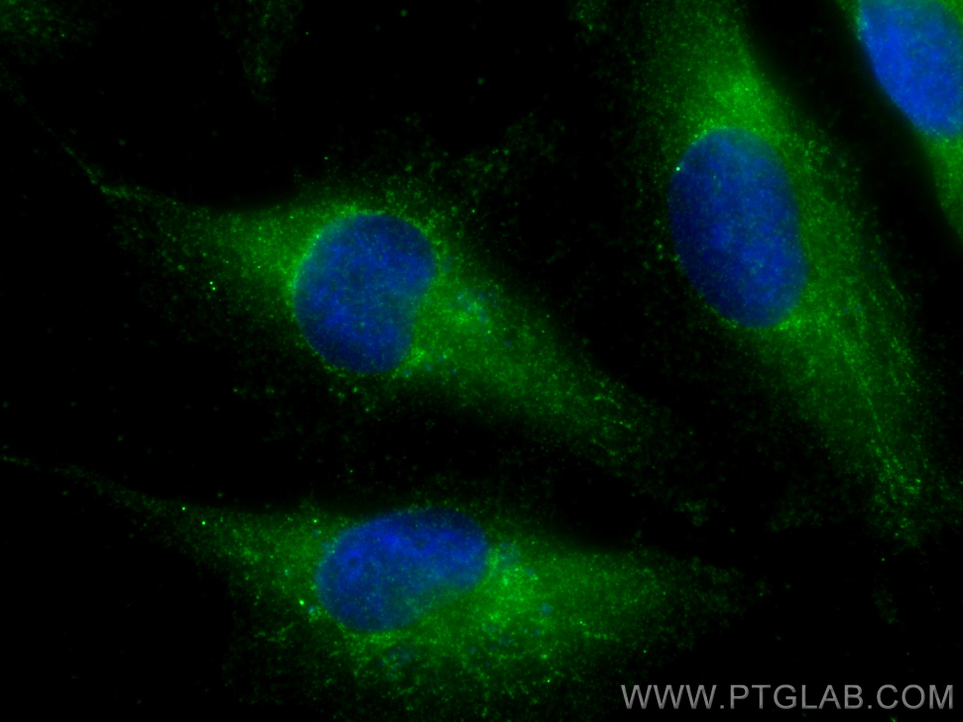 IF Staining of U-251 using 13340-1-AP