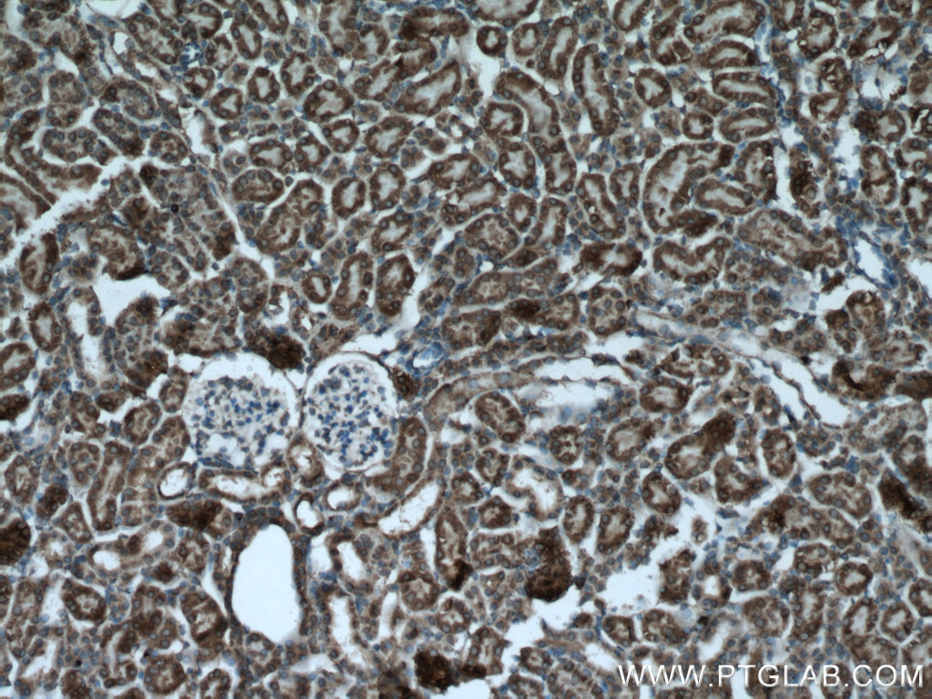 IHC staining of mouse kidney using 13340-1-AP