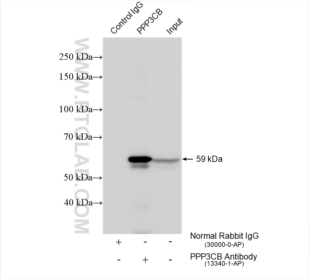 IP experiment of mouse brain using 13340-1-AP