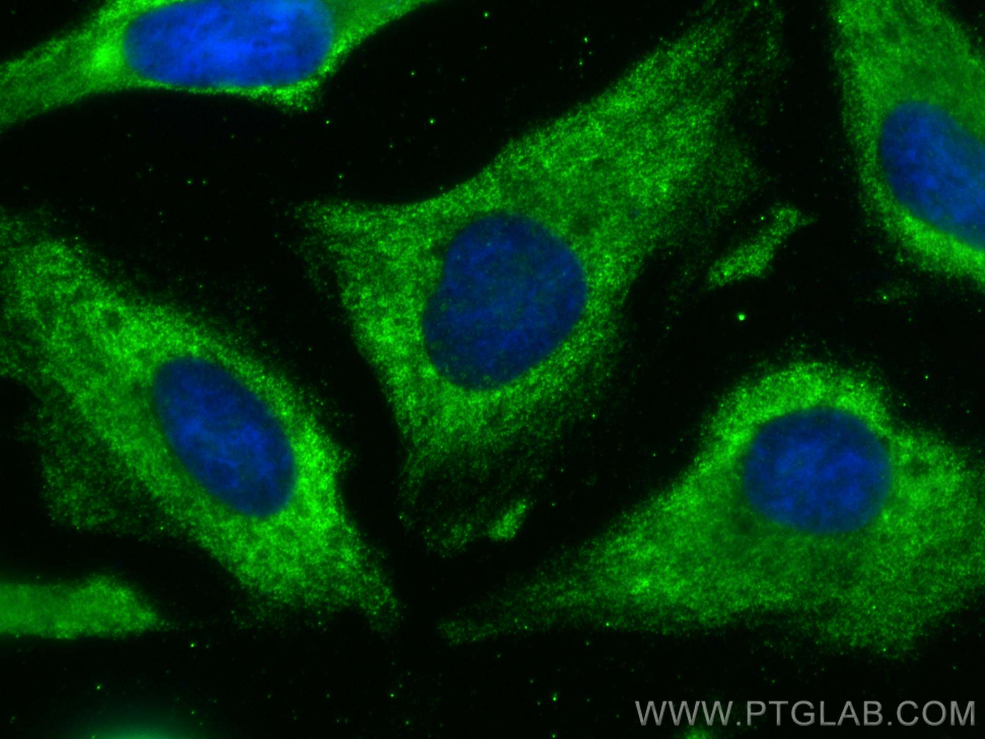 IF Staining of HeLa using 66614-1-Ig