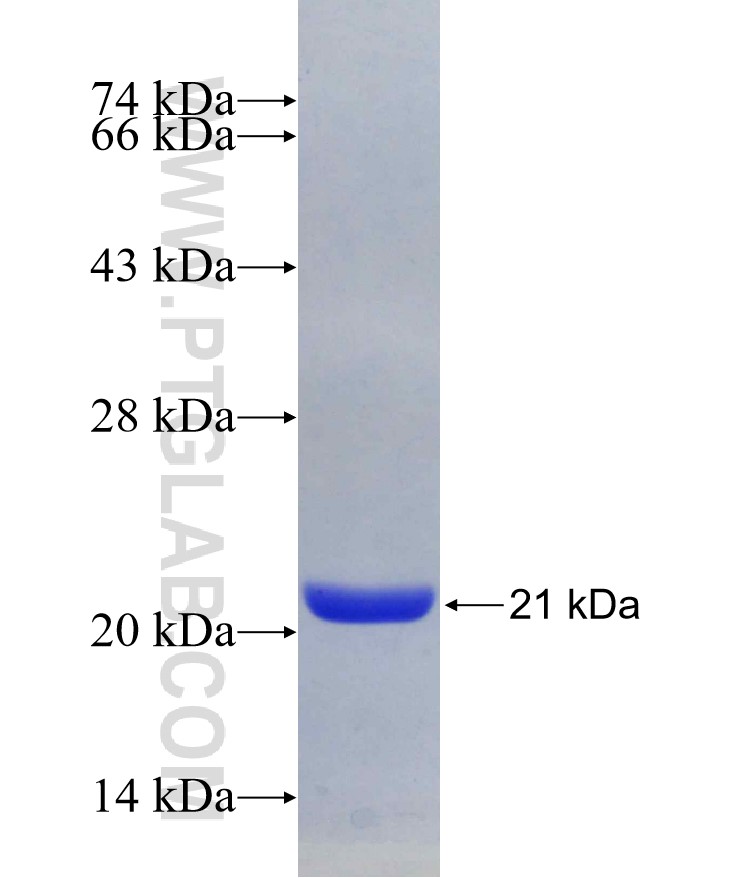 PPP3R1 fusion protein Ag29405 SDS-PAGE