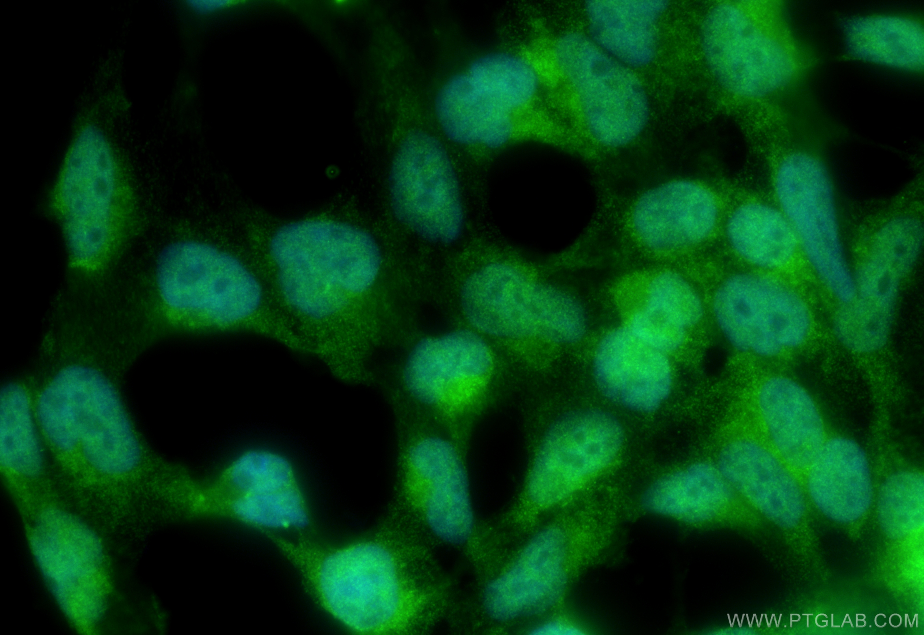 IF Staining of HEK-293 using 10262-1-AP