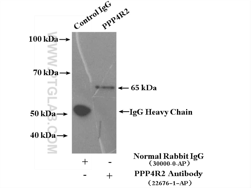 IP experiment of HepG2 using 22676-1-AP