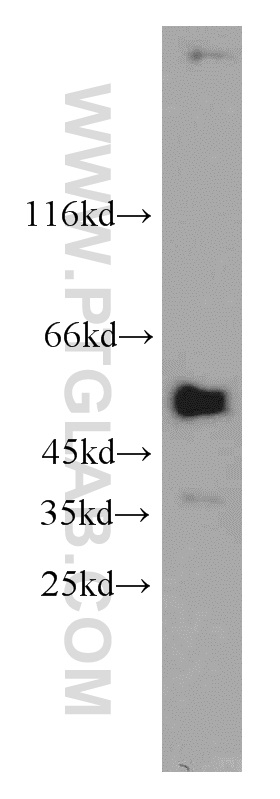 WB analysis of A549 using 22676-1-AP