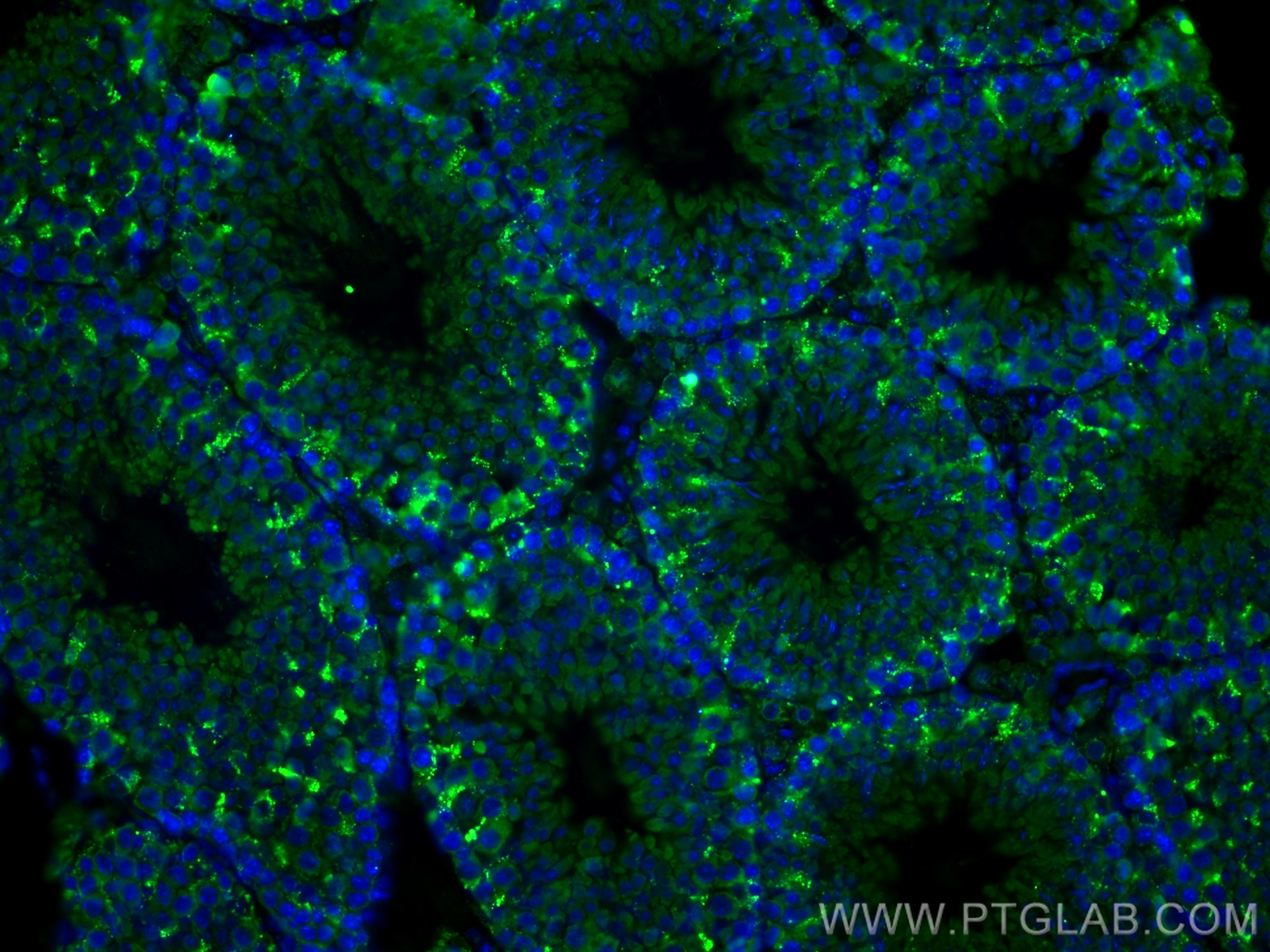 IF Staining of mouse testis using 29653-1-AP