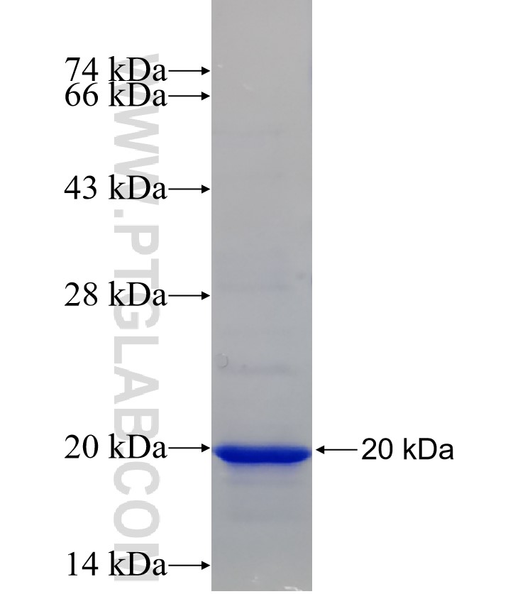PPT1 fusion protein Ag31240 SDS-PAGE