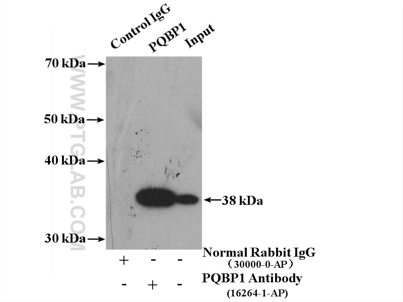 IP experiment of mouse brain using 16264-1-AP