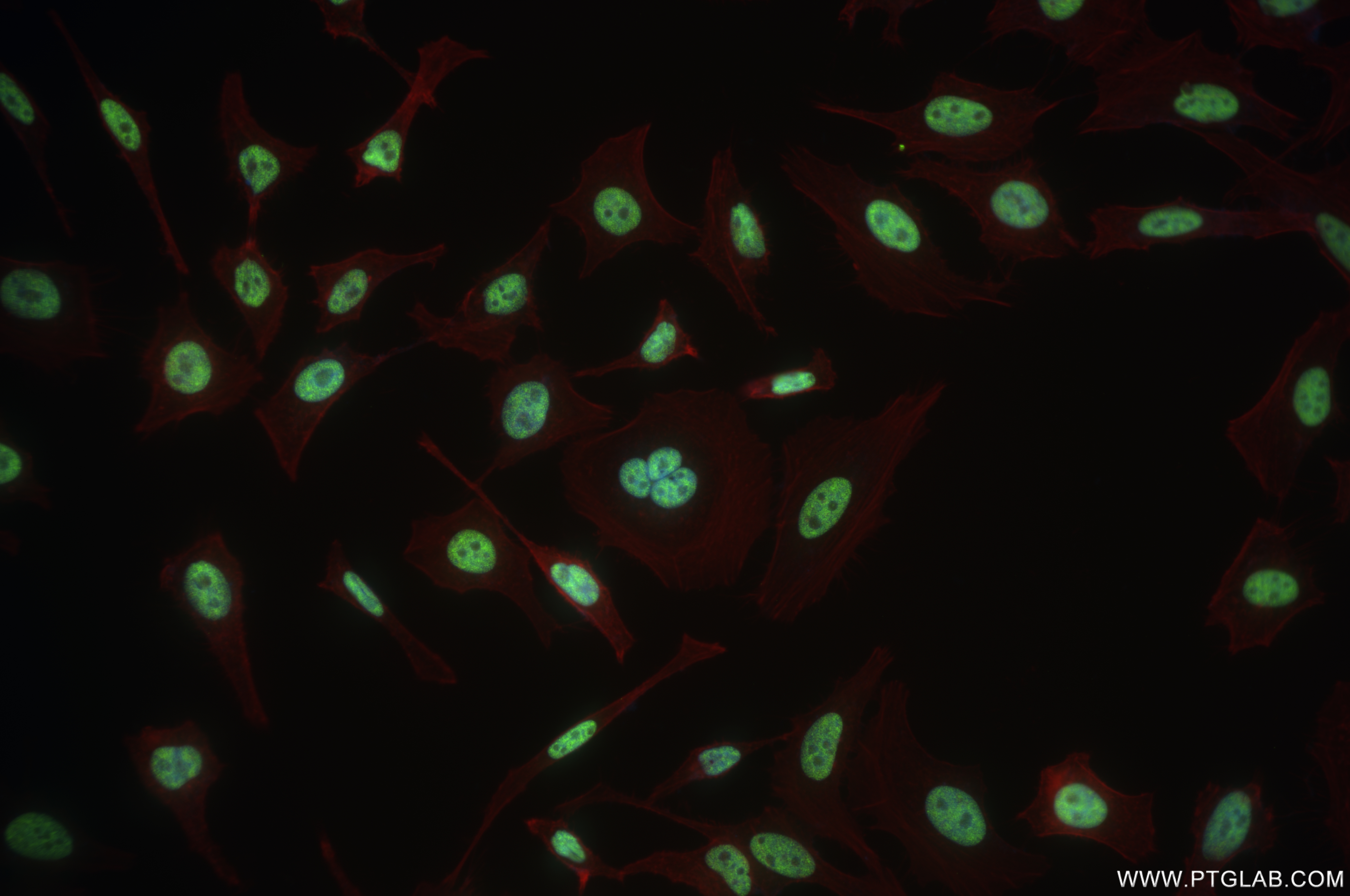 IF Staining of HeLa using 84491-3-RR (same clone as 84491-3-PBS)