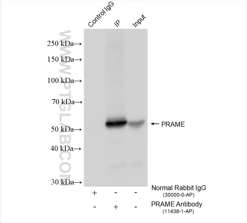 IP experiment of K-562 using 11438-1-AP