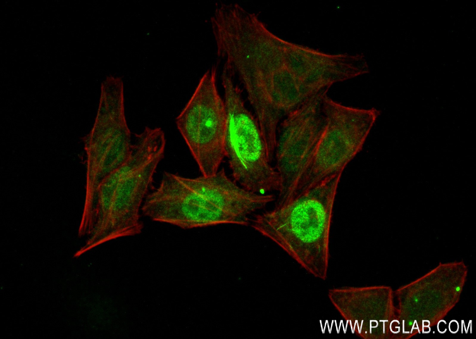 IF Staining of HepG2 using 84041-2-RR (same clone as 84041-2-PBS)