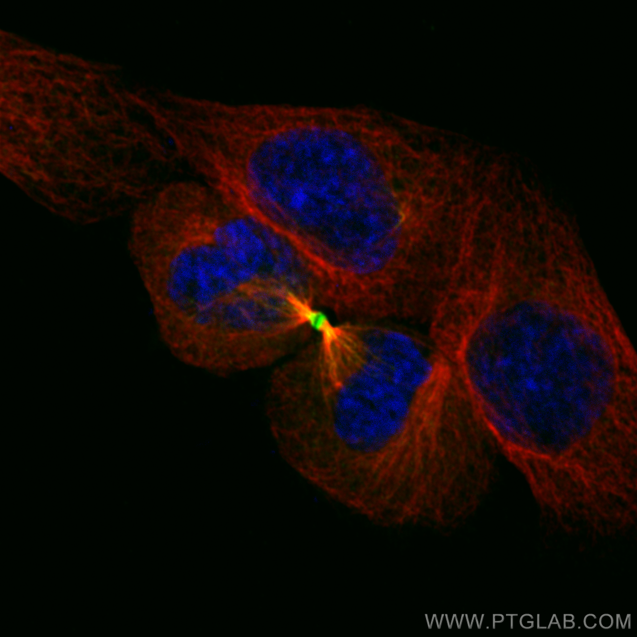 IF Staining of HepG2 using 84041-2-RR (same clone as 84041-2-PBS)