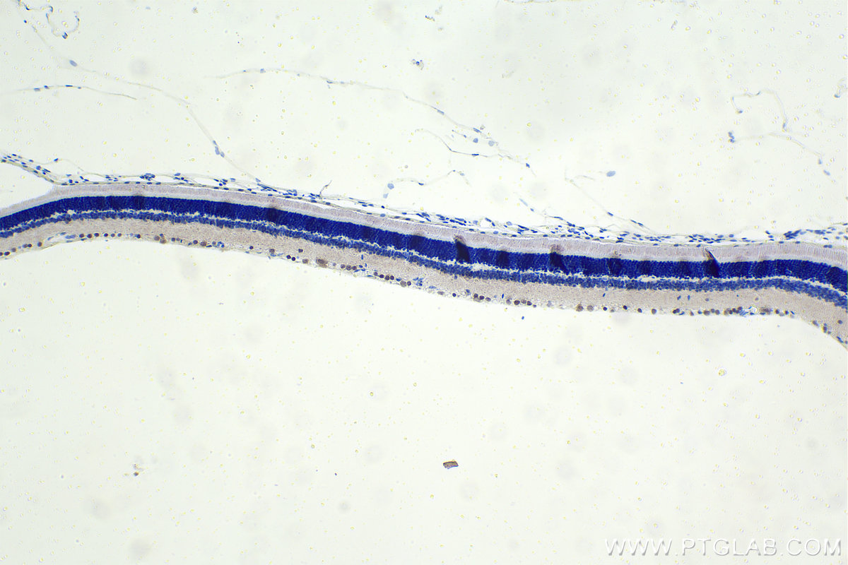 IHC staining of rat eye using 30453-1-AP