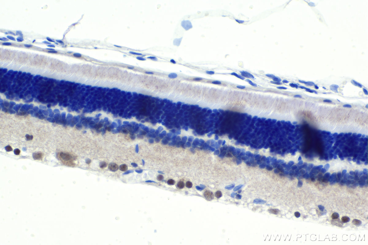 IHC staining of rat eye using 30453-1-AP