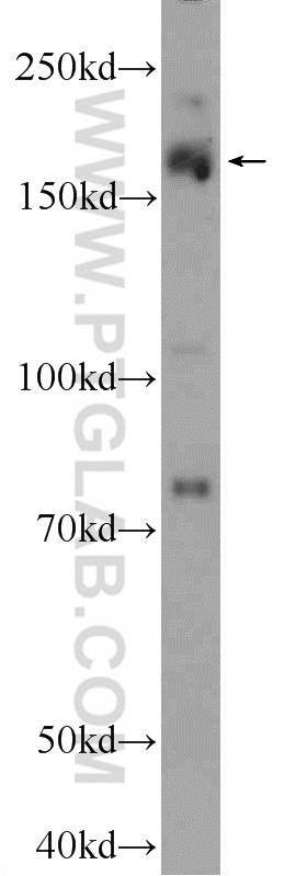 WB analysis of MCF-7 using 25590-1-AP