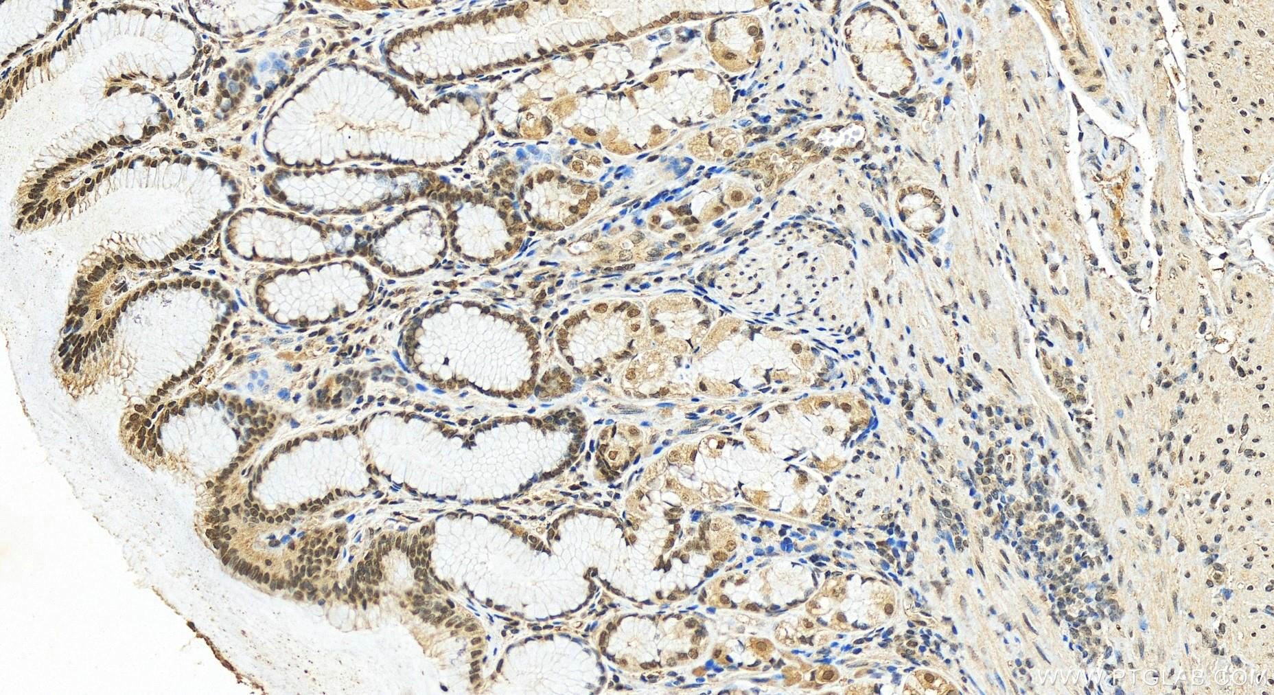 IHC staining of human stomach using 55361-1-AP