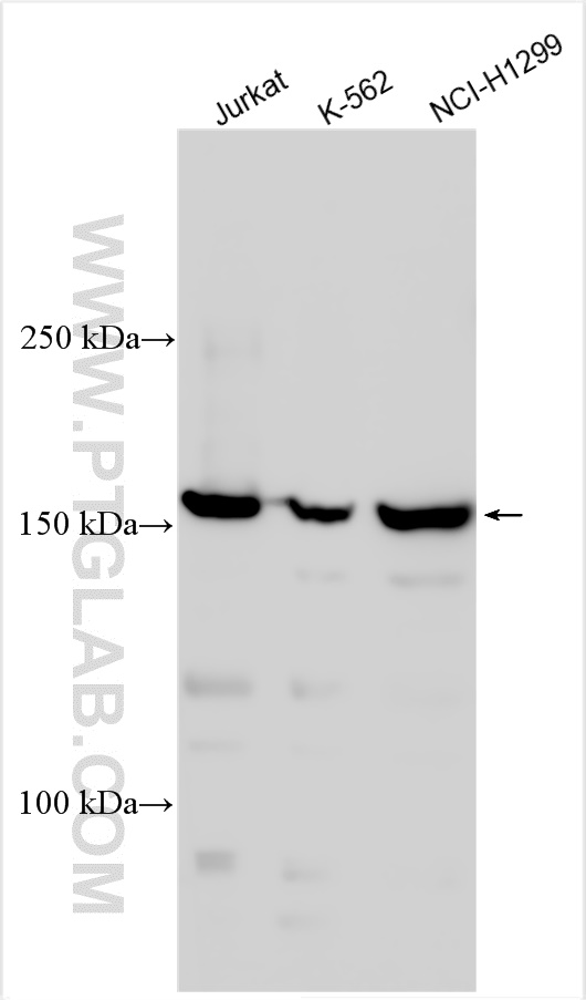 WB analysis using 55361-1-AP