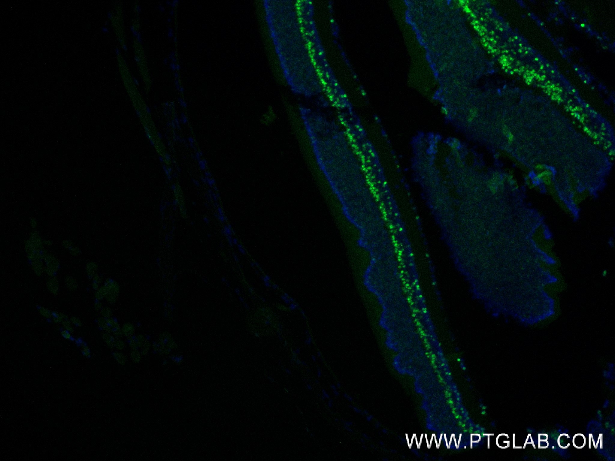 IF Staining of mouse eye using 84716-2-RR