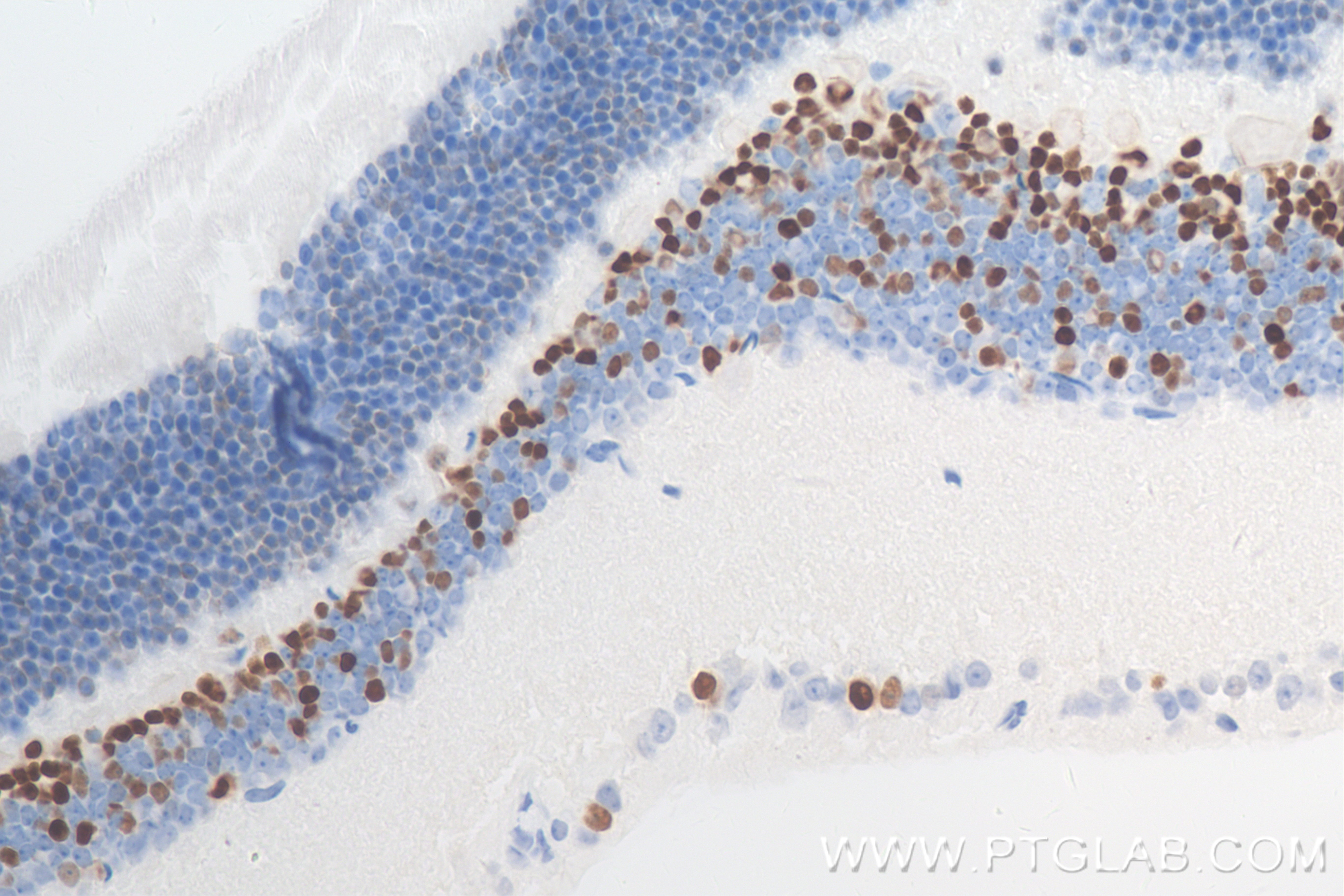 IHC staining of mouse eye using 84716-2-RR