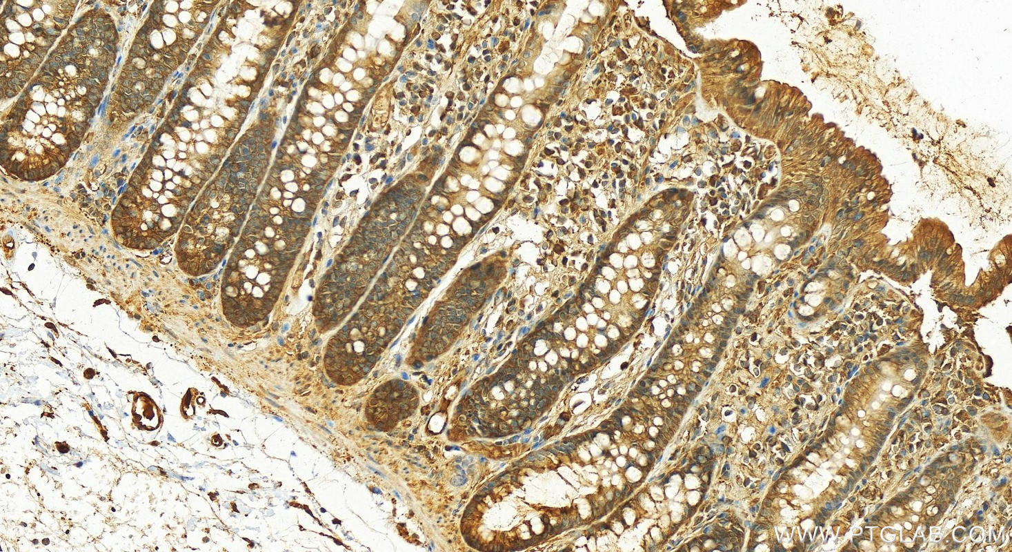 IHC staining of human colon using 15816-1-AP