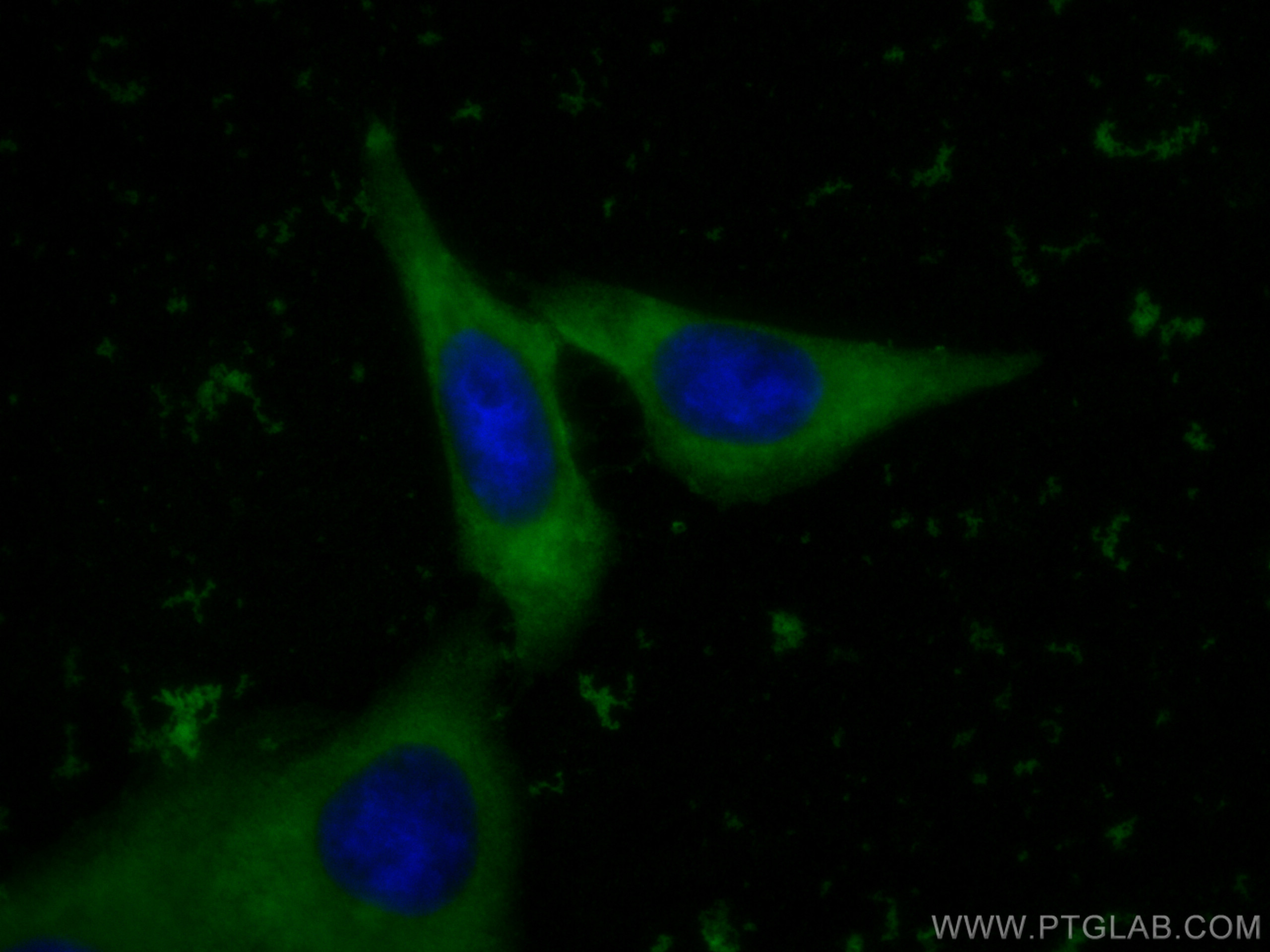 peroxiredoxin 2