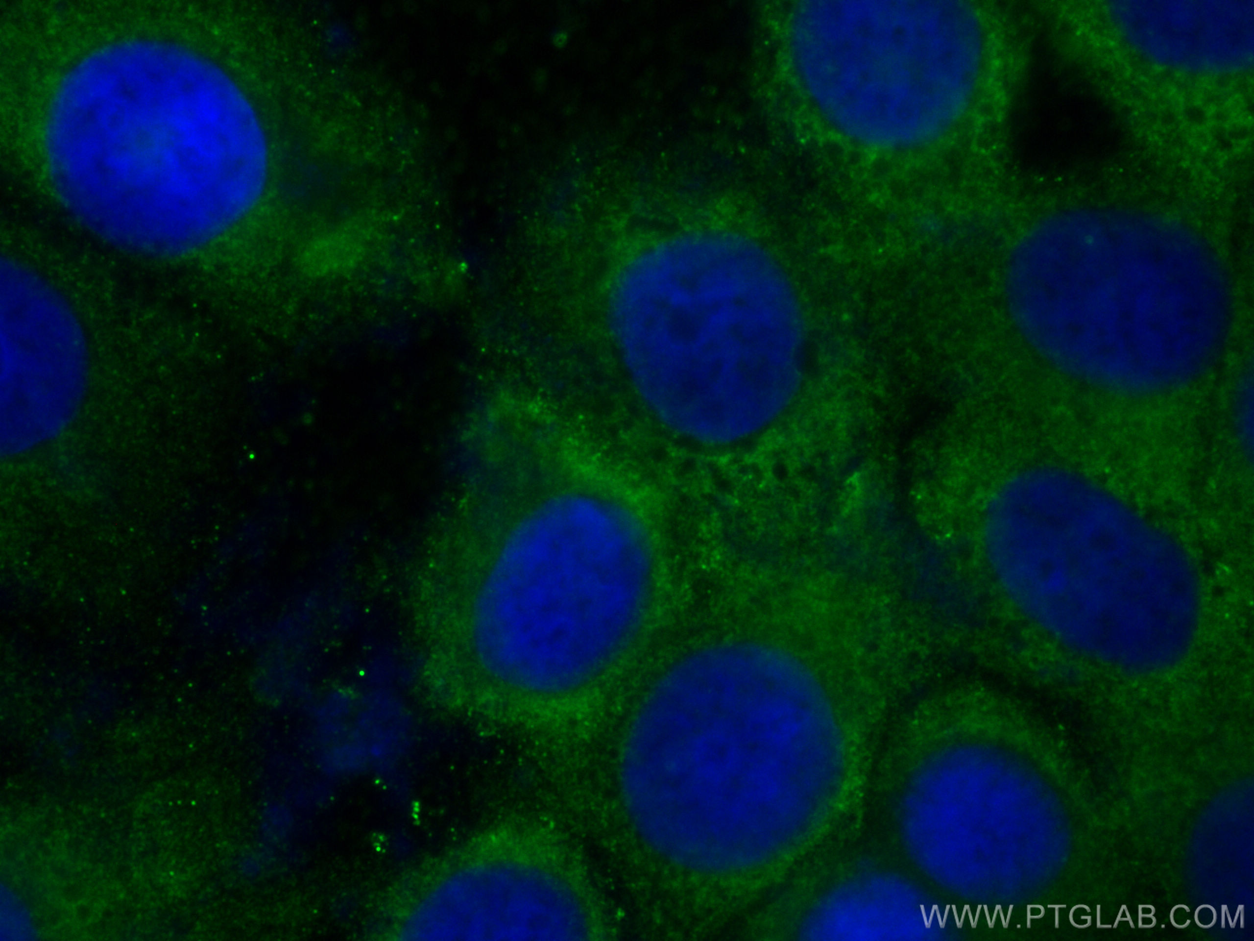 IF Staining of MCF-7 using 60202-1-Ig (same clone as 60202-1-PBS)