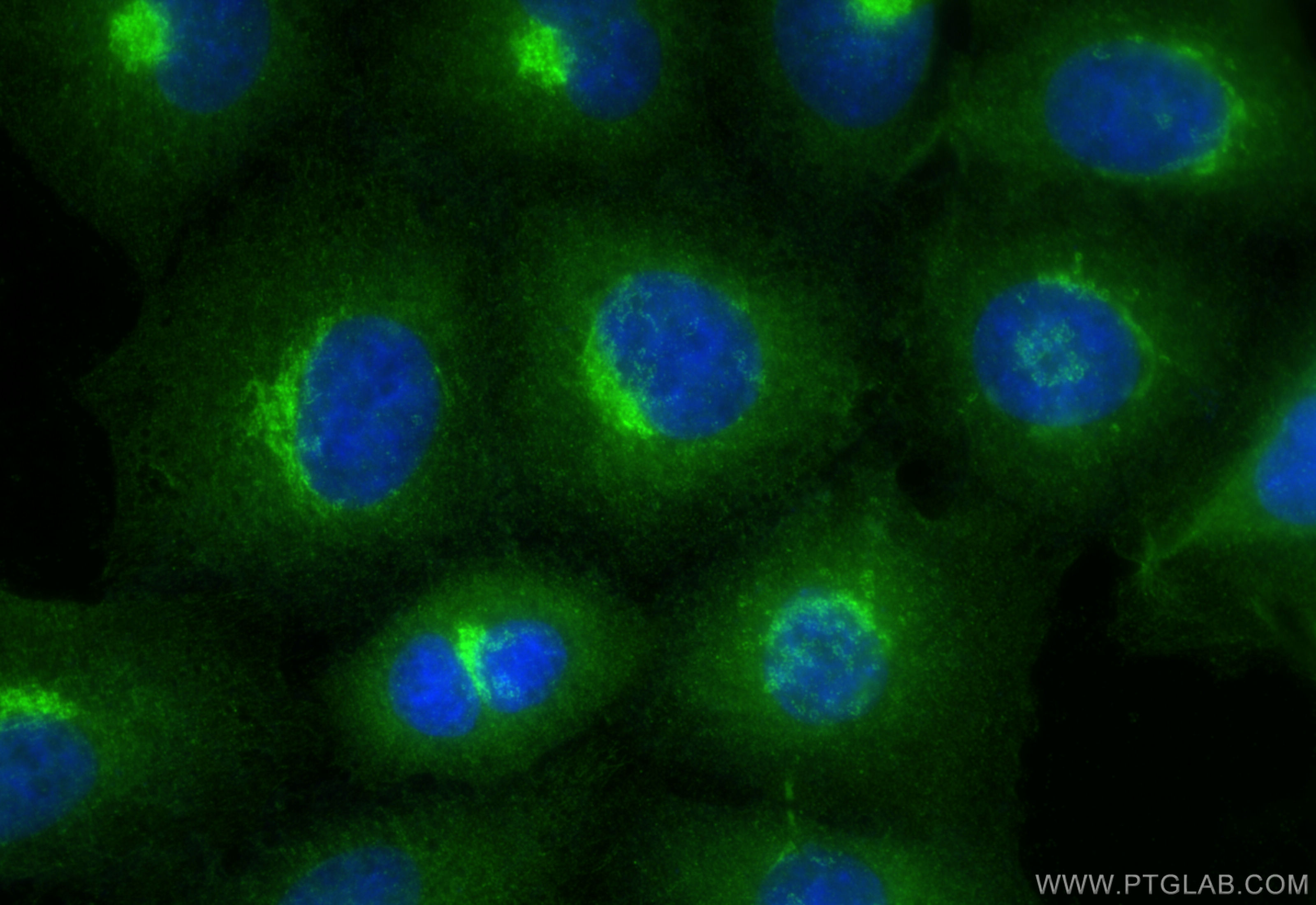 IF Staining of A549 using 55087-1-AP