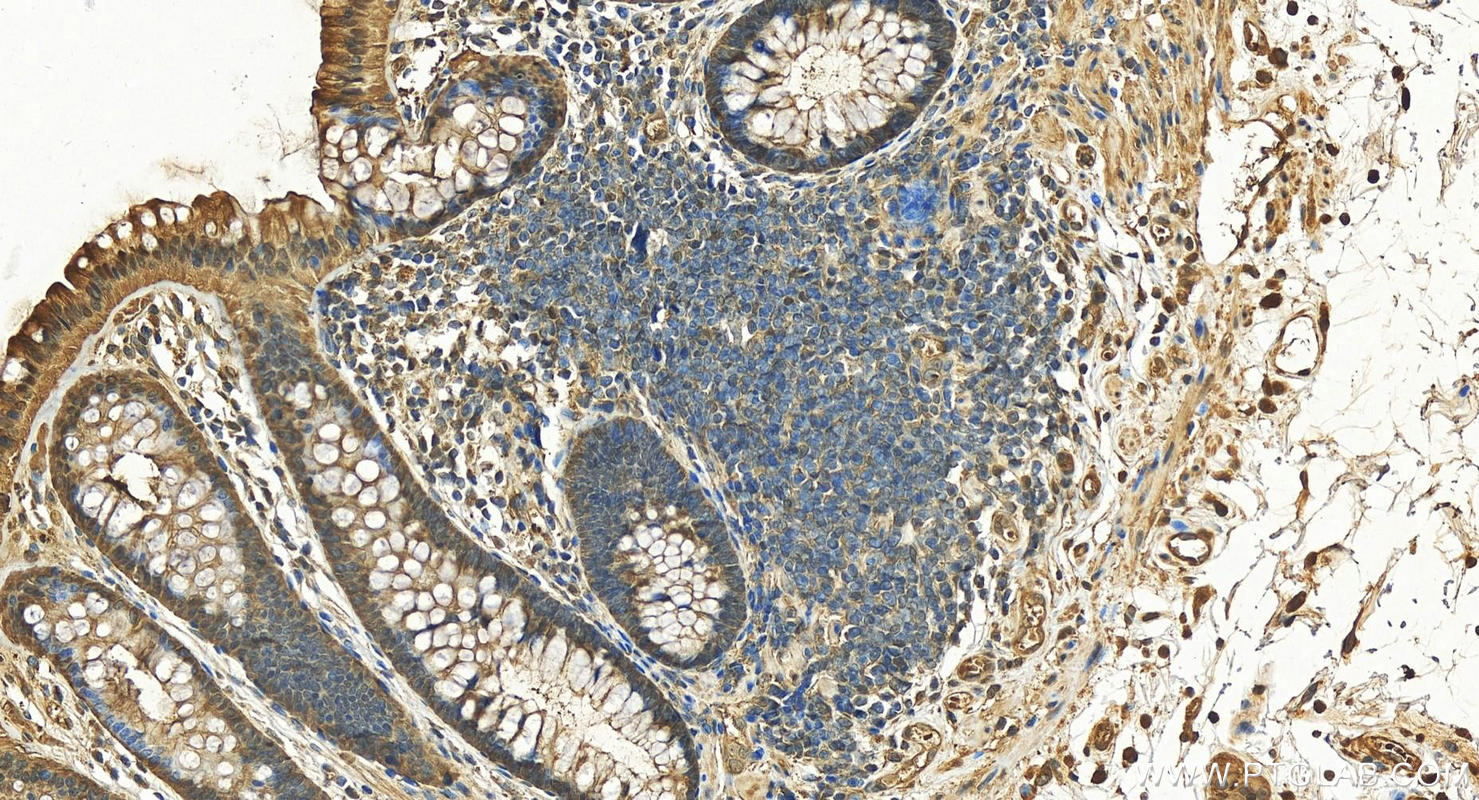 IHC staining of human colon using 13585-1-AP