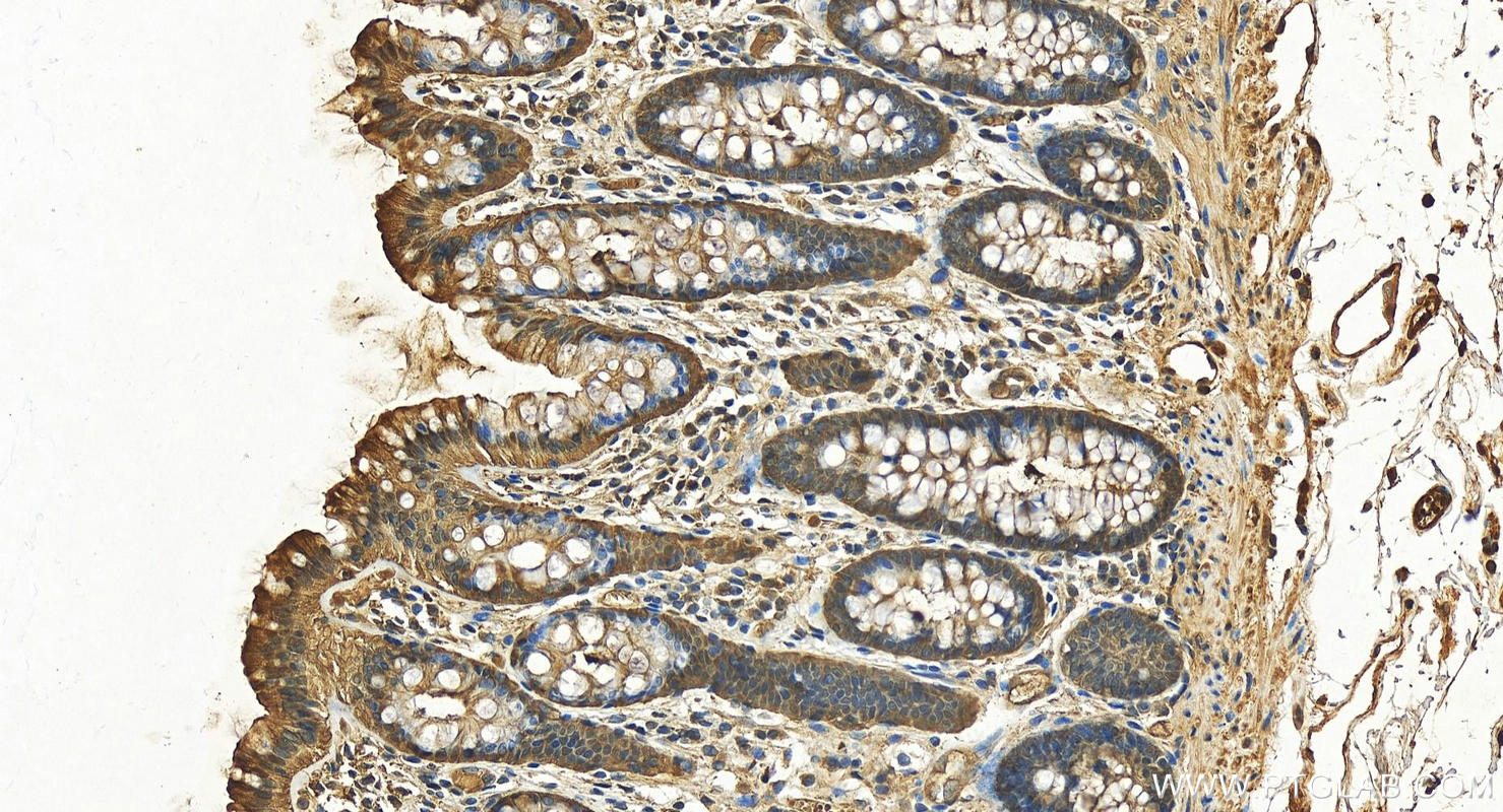 IHC staining of human colon using 13585-1-AP