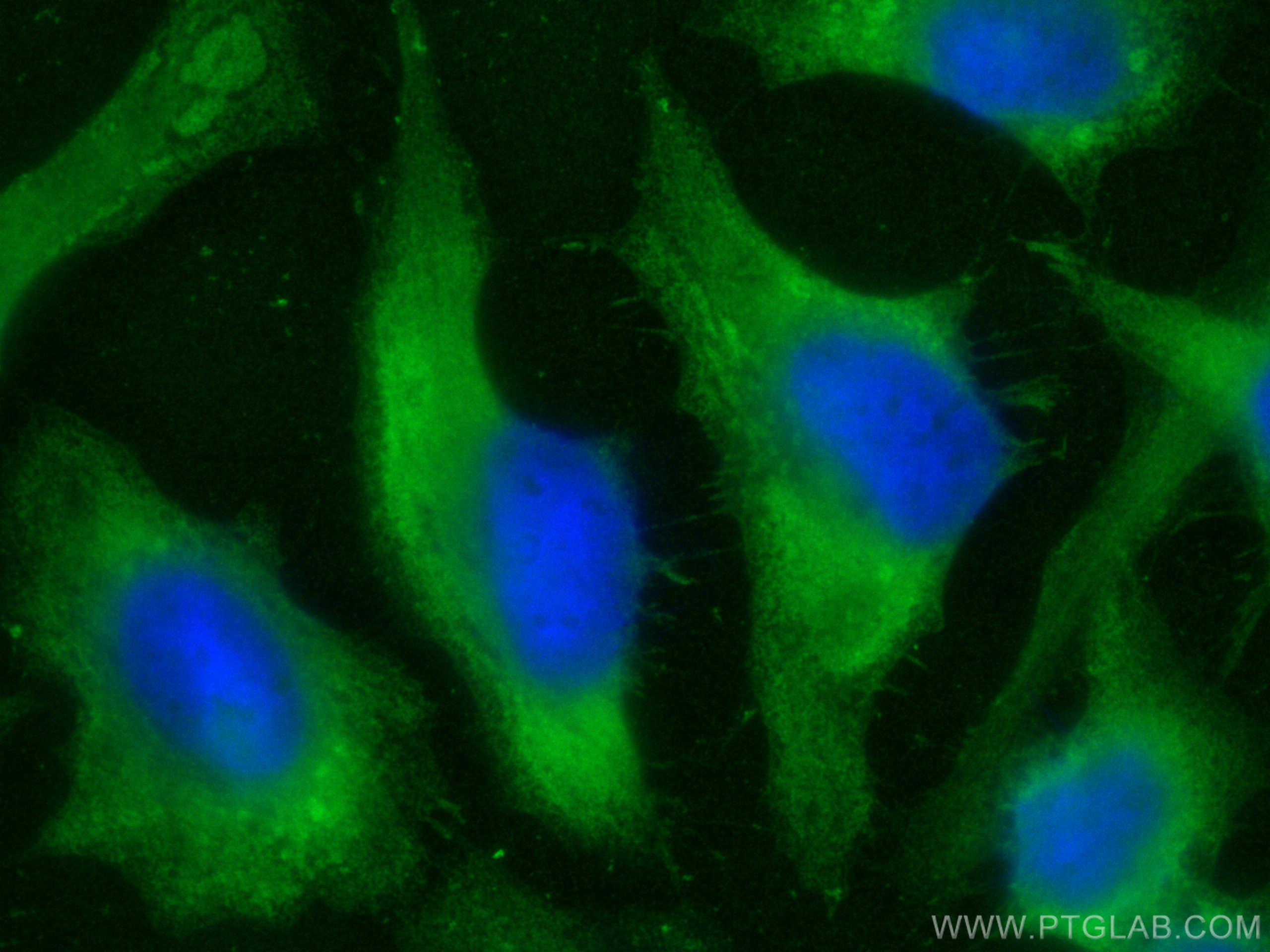 IF Staining of HeLa using 13585-1-AP