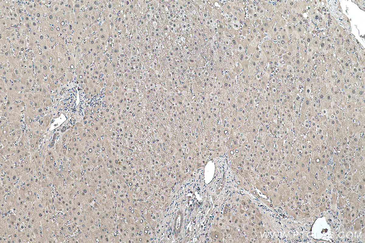 IHC staining of human liver using 67499-1-Ig