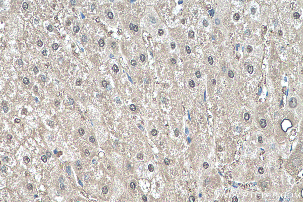 IHC staining of human liver using 67499-1-Ig