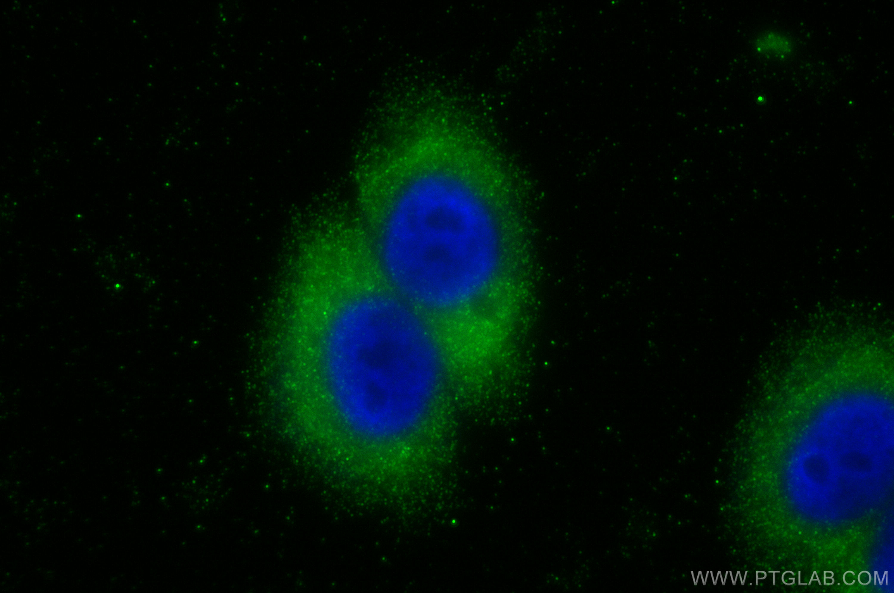 IF Staining of HepG2 using 10146-2-AP