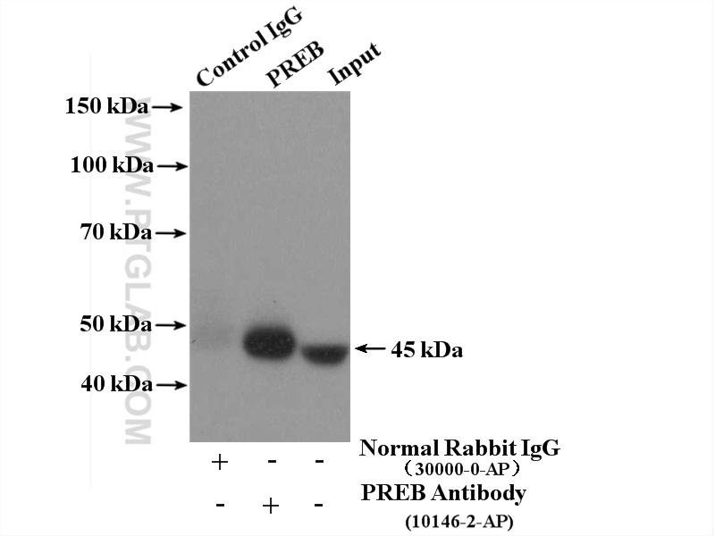 IP experiment of SKOV-3 using 10146-2-AP