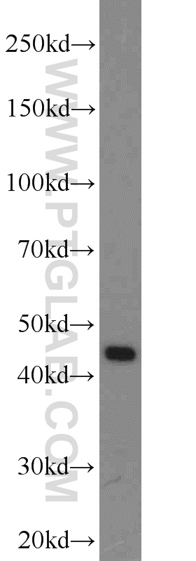 WB analysis of SKOV-3 using 10146-2-AP