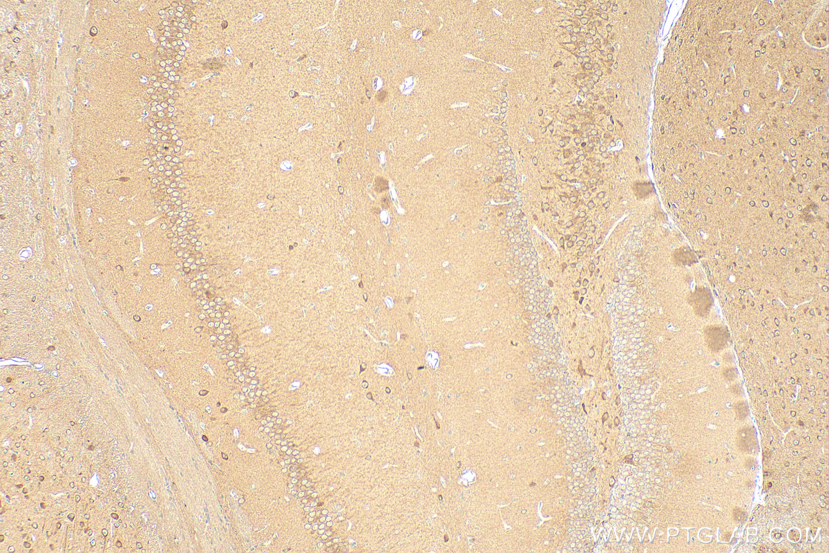 IHC staining of mouse brain using 12478-1-AP