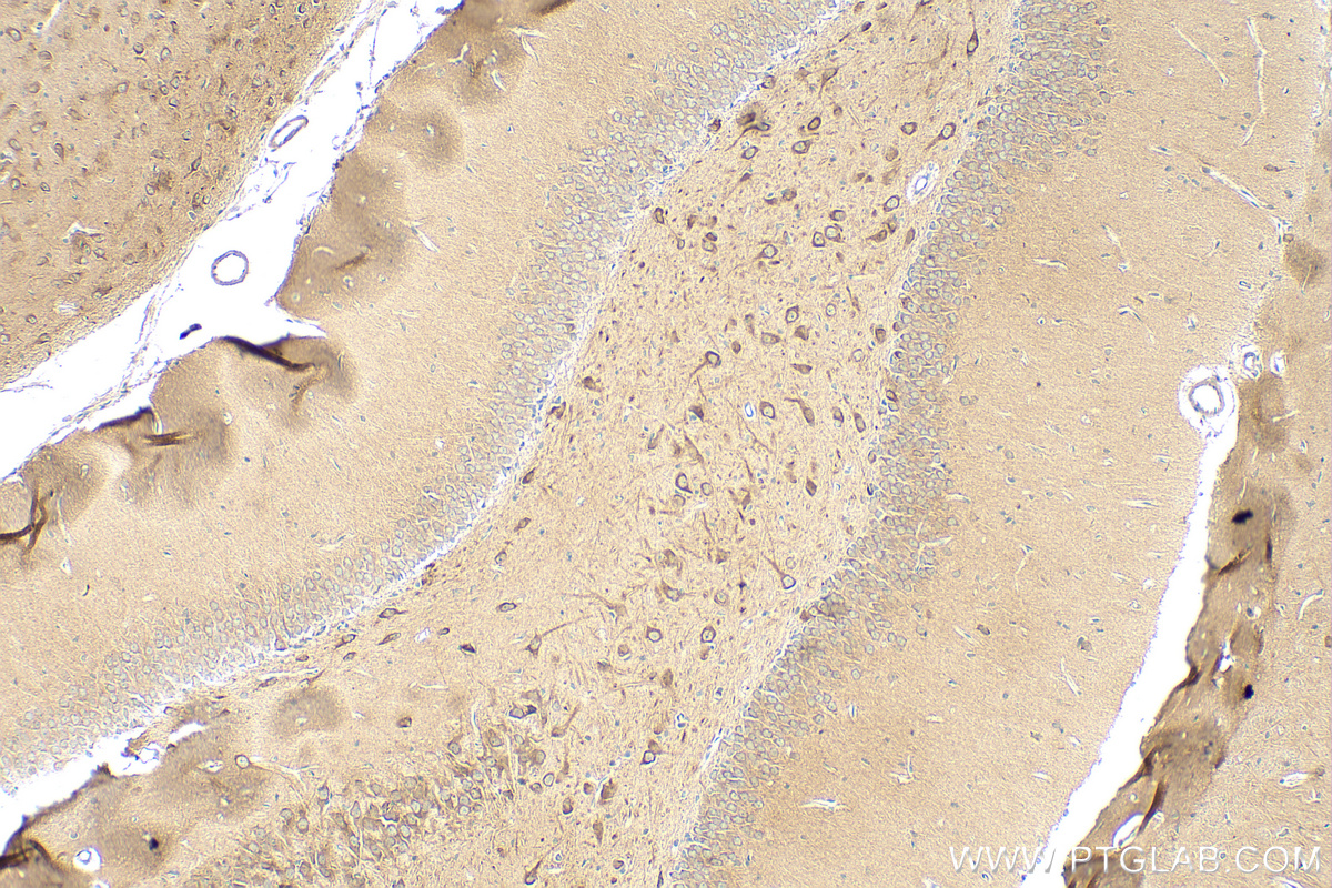 IHC staining of rat brain using 12478-1-AP