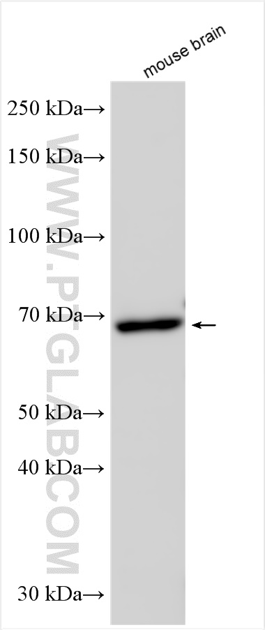 WB analysis of mouse brain using 12478-1-AP