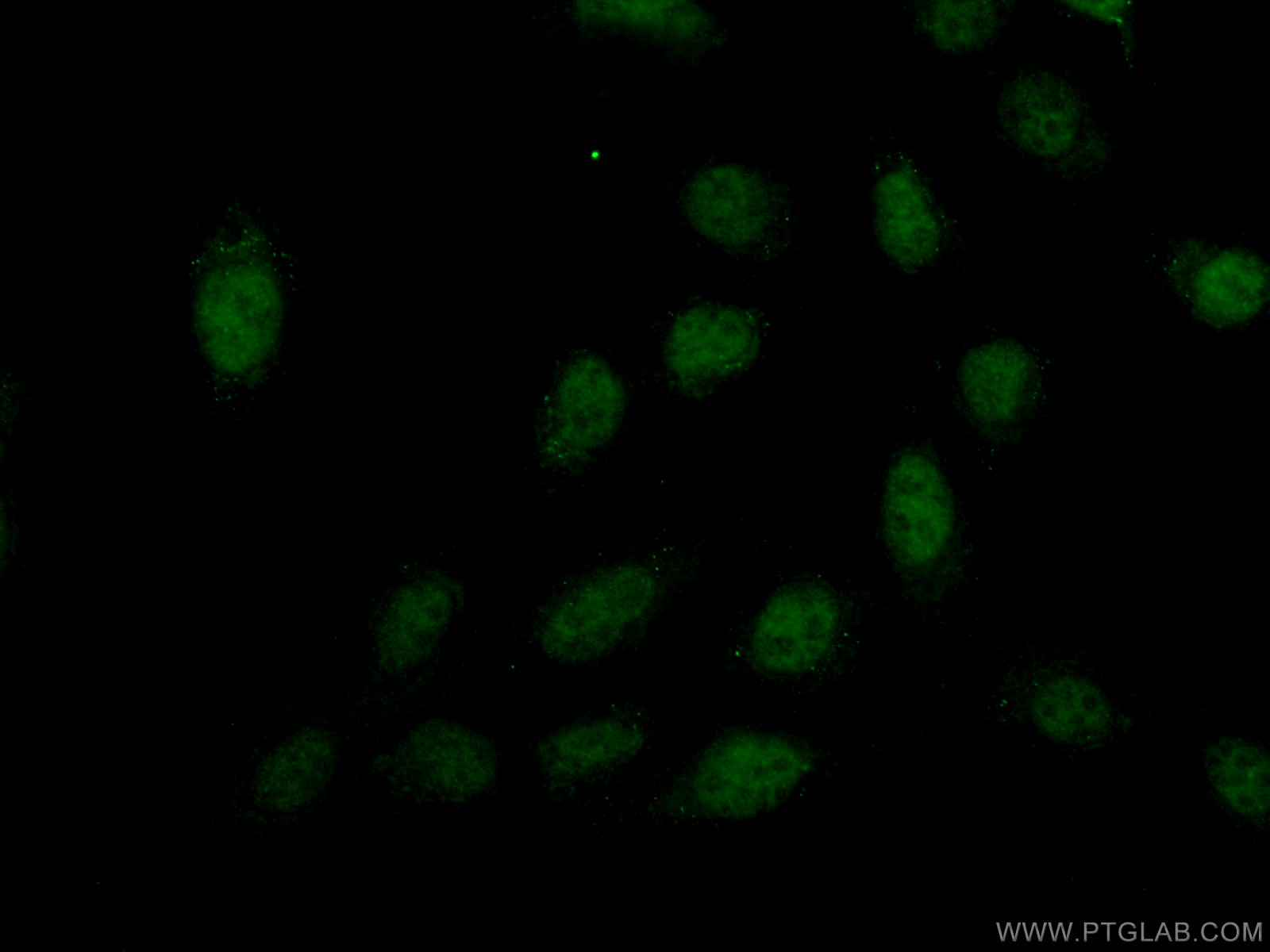 IF Staining of U2OS using 24195-1-AP