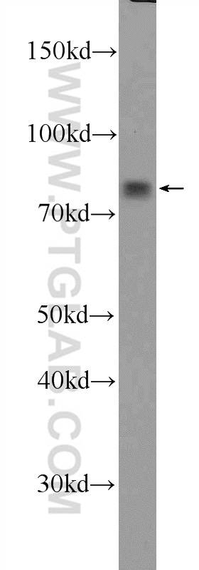 WB analysis of K-562 using 25936-1-AP