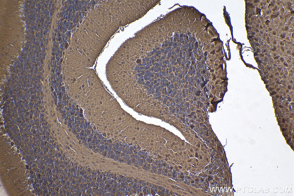 IHC staining of mouse cerebellum using 22589-1-AP